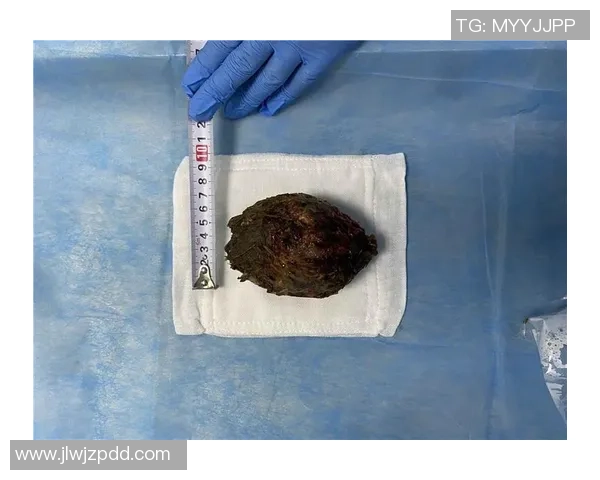 库卢社媒更新状态透露膝盖小手术恢复良好现状一瘸一拐并无大碍